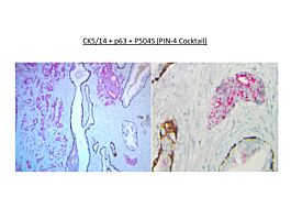 PIN4 34bE12/P63/AMACR, IHC Control Slides