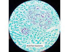 AFB / Acid Fast Bacteria Special Stain Control Slides