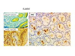 Helico Bacteria / H Pylori Special Stain Control Slides