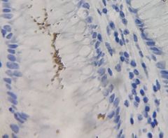 HPL: H Pylori Control Slides - Item #10-IHC-HPL-100