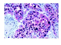 Melanoma marker Multiplex control slides, KI67/Melan A, Box 100 (99 unstained + 1 stained containing 1st & 100 sections stained)-10-IHCM-MLNM-100