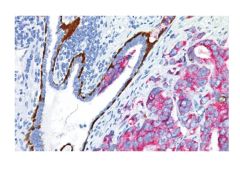 Prostate Multiplex Marker Control Slides, PIN4 (CK5/14+P63+P504S), 25 (24 unstained 1 stained) -10-IHCM-PIN4-25