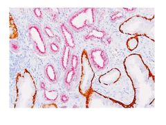 Prostate Multiplex Marker Control Slides, CK HMW+P63+AMA Box 25 (24 + 1 Stained)- Item #10-IHCM-PRST-25